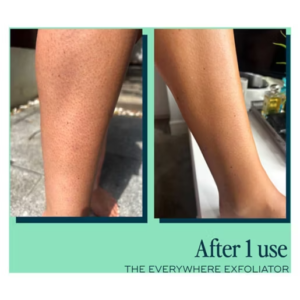 Luna Daily The Everywhere Exfoliator with AHAs for Keratosis Pilaris, Ingrowns & Smoother Skin 180ml - Image 6